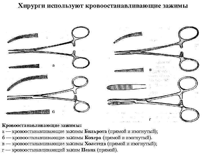 Хирурги используют кровоостанавливающие зажимы Кровоостанавливающие зажимы: а — кровоостанавливающие зажимы Бильрота (прямой и изогнутый);