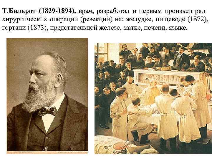 Т. Бильрот (1829 -1894), врач, разработал и первым произвел ряд хирургических операций (резекций) на: