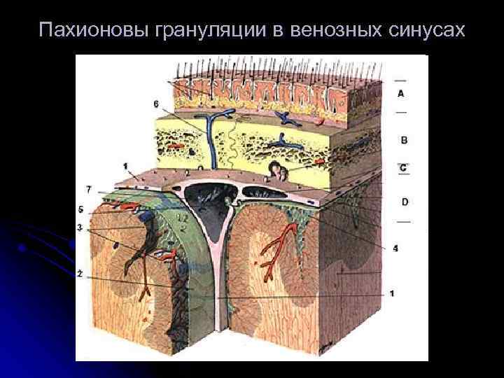 Пахионовы грануляции в венозных синусах 