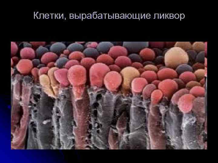 Клетки, вырабатывающие ликвор 