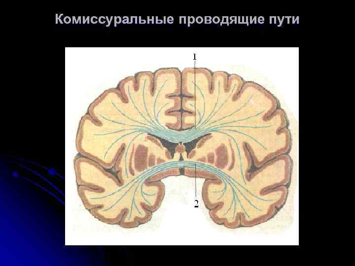 Комиссуральные проводящие пути 