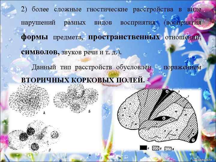 2) более сложные гностические расстройства в виде нарушений разных видов восприятия (восприятия формы предмета,
