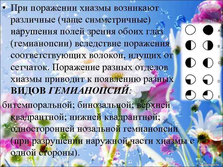  • При поражении хиазмы возникают различные (чаще симметричные) нарушения полей зрения обоих глаз