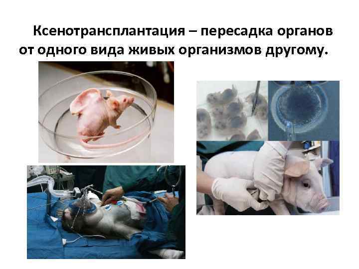 Ксенотрансплантация – пересадка органов от одного вида живых организмов другому. 