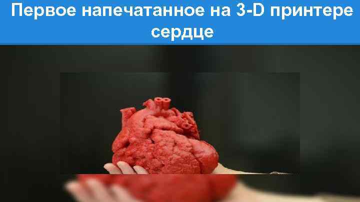 Первое напечатанное на 3 -D принтере сердце 