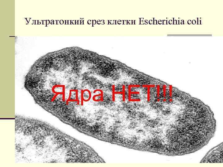 Ультратонкий срез клетки Escherichia coli Ядра НЕТ!!! 