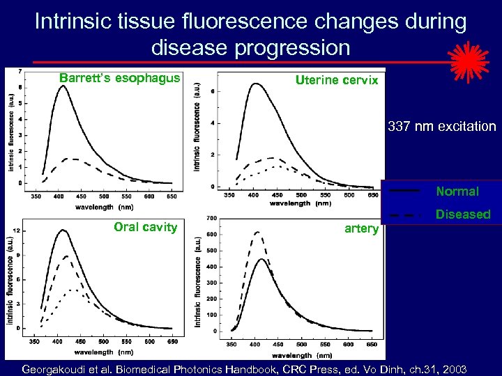 Intrinsic tissue fluorescence changes during disease progression Barrett’s esophagus Uterine cervix 337 nm excitation