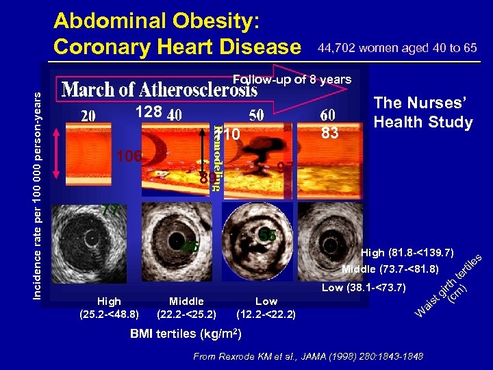 Abdominal Obesity: Coronary Heart Disease 44, 702 women aged 40 to 65 Incidence rate