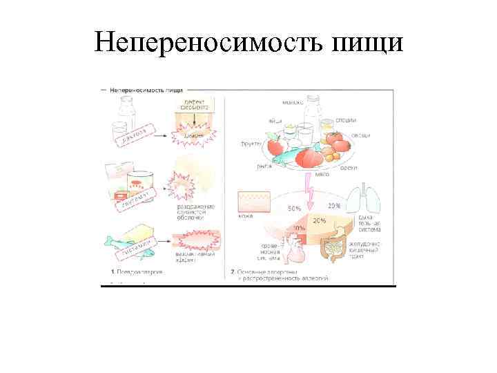 Непереносимость пищи 