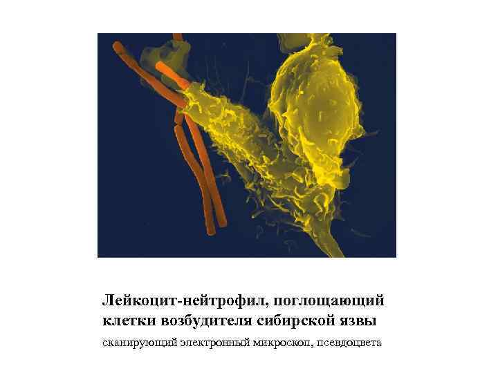 Лейкоцит-нейтрофил, поглощающий клетки возбудителя сибирской язвы сканирующий электронный микроскоп, псевдоцвета 