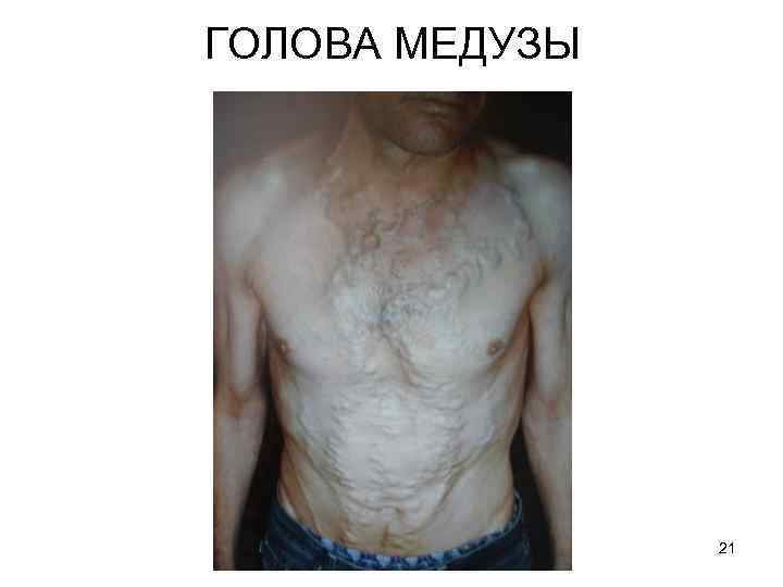 ГОЛОВА МЕДУЗЫ 21 
