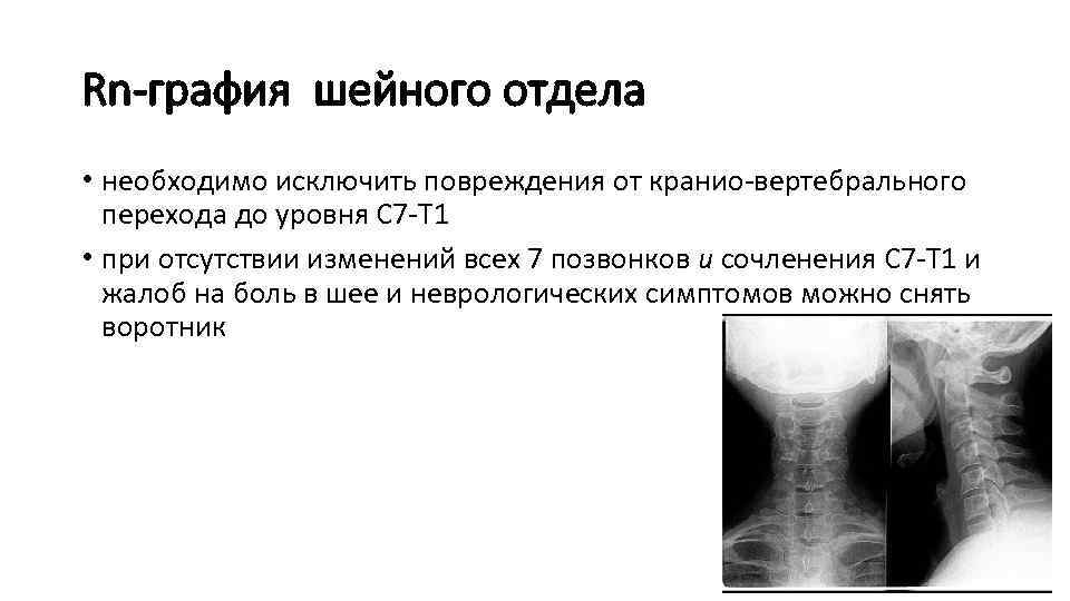 Графия это. R графия шейного отдела. Рентген шейного отдела позвоночника описание. Расшифровка рентгеновских снимков позвоночника. Кранио вертебральный отдел.