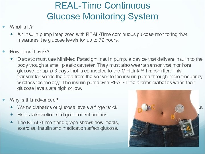 REAL-Time Continuous Glucose Monitoring System What is it? An insulin pump integrated with REAL-Time