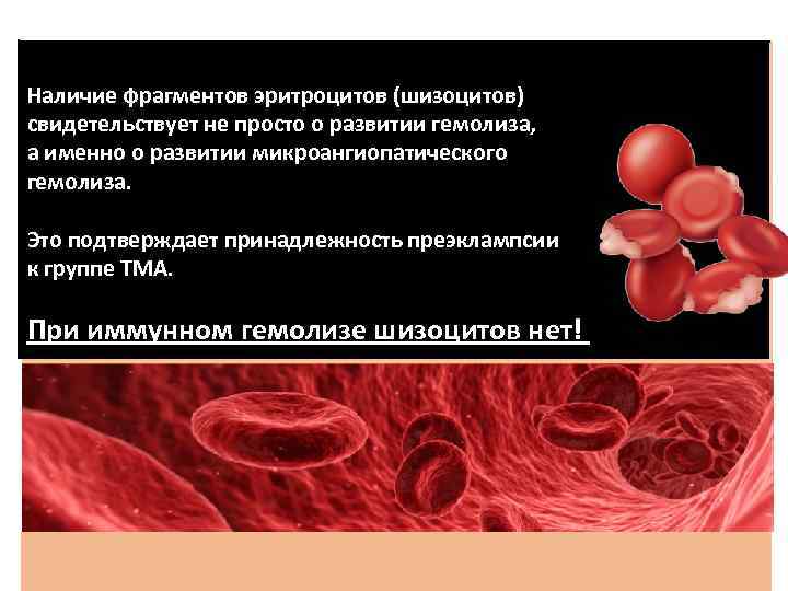 Наличие фрагментов эритроцитов (шизоцитов) свидетельствует не просто о развитии гемолиза, а именно о развитии
