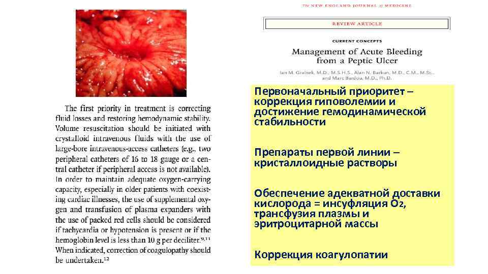 Первоначальный приоритет – коррекция гиповолемии и достижение гемодинамической стабильности Препараты первой линии – кристаллоидные