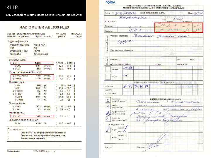 КЩР ГАК молодой пациентки после одного неприятного события 