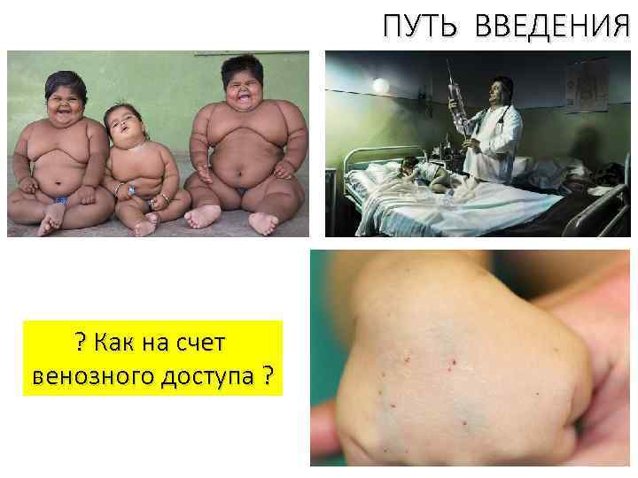ПУТЬ ВВЕДЕНИЯ ? Как на счет венозного доступа ? 