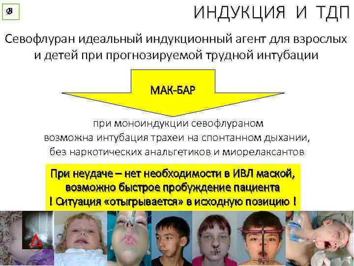 В ИНДУКЦИЯ И ТДП Севофлуран идеальный индукционный агент для взрослых и детей при прогнозируемой