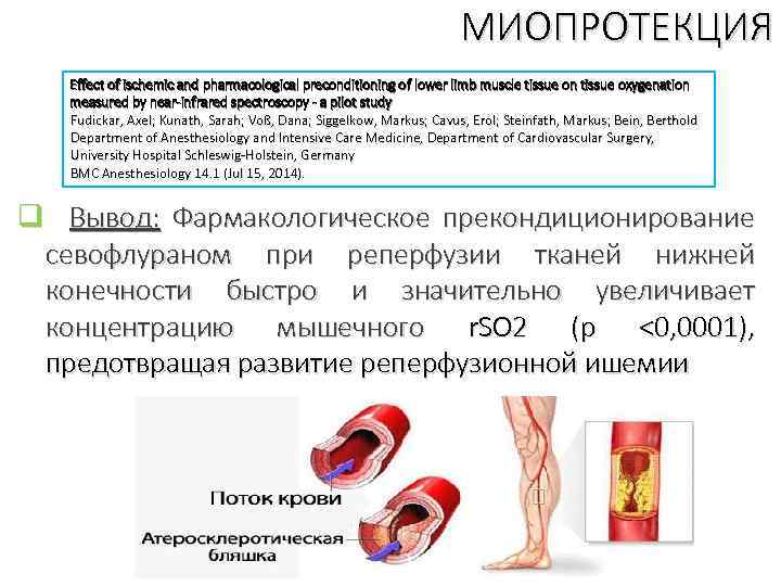 МИОПРОТЕКЦИЯ Effect of ischemic and pharmacological preconditioning of lower limb muscle tissue on tissue