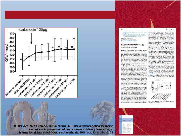 M. Bruyere, N. Ait Hamou, D. Benhamou. QT interval prolongation following carbetocin in prevention