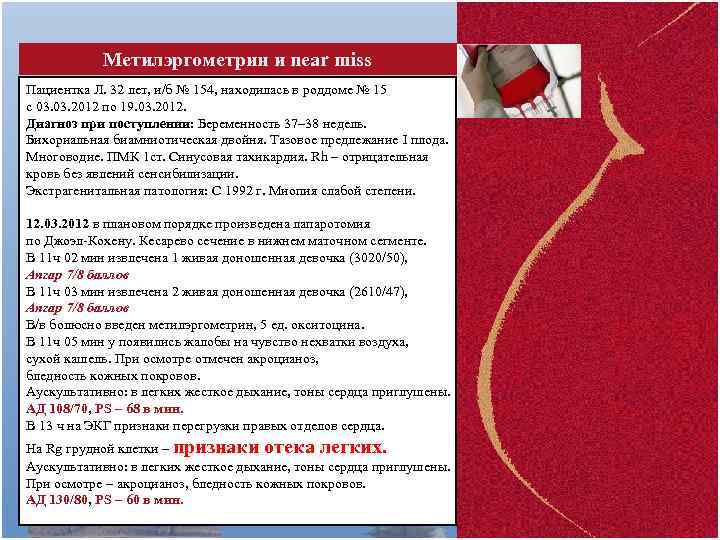 Метилэргометрин и near miss Пациентка Л. 32 лет, и/б № 154, находилась в роддоме