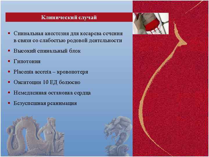 Клинический случай § Спинальная анестезия для кесарева сечения в связи со слабостью родовой деятельности
