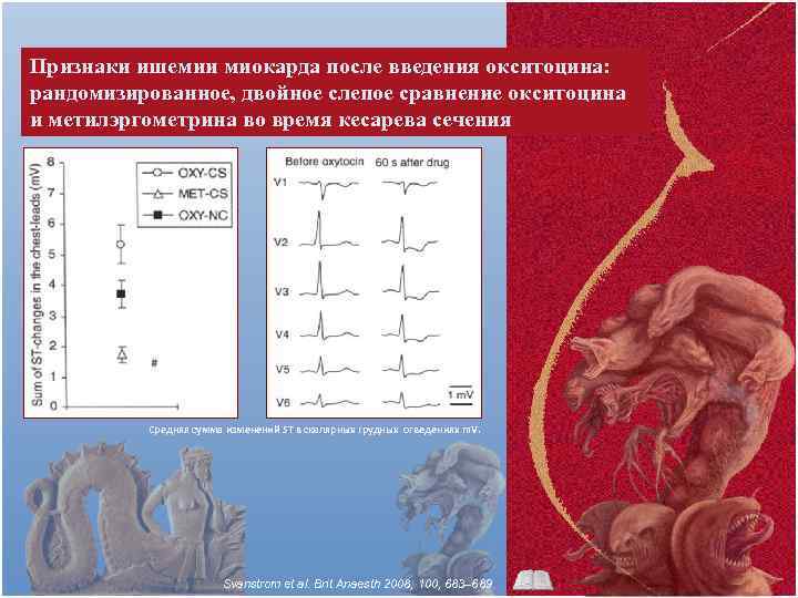Признаки ишемии миокарда после введения окситоцина: рандомизированное, двойное слепое сравнение окситоцина и метилэргометрина во