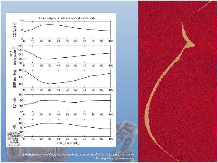 International Journal of Obstetric Anesthesia 2011 20, 26 -29 DOI: (10. 1016/j. ijoa. 2010.
