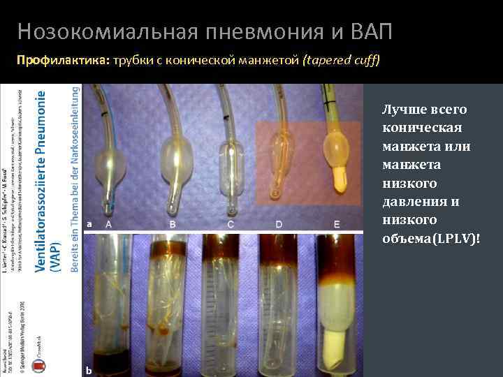 Нозокомиальная пневмония и ВАП Профилактика: трубки с конической манжетой (tapered cuff) Лучше всего коническая