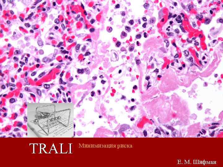 1 TRALI Минимизация риска Е. М. Шифман 