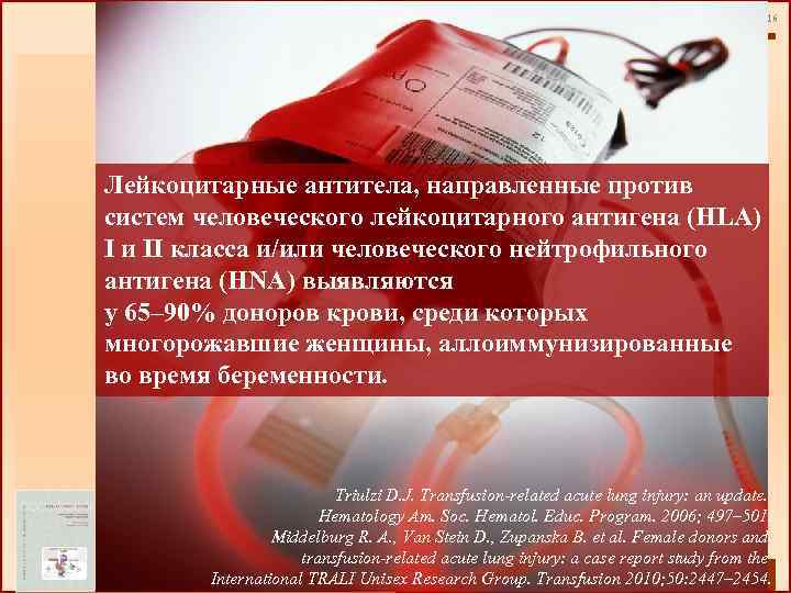 16 Лейкоцитарные антитела, направленные против систем человеческого лейкоцитарного антигена (HLA) I и II класса