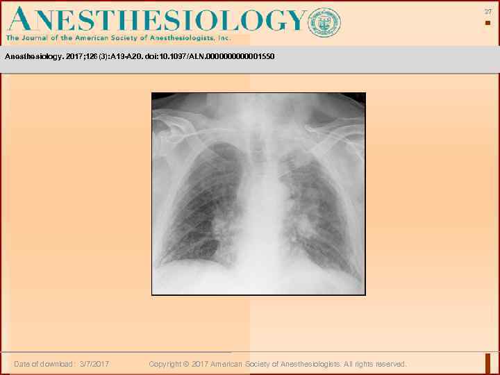 27 Anesthesiology. 2017; 126(3): A 19 -A 20. doi: 10. 1097/ALN. 0000001550 Date of