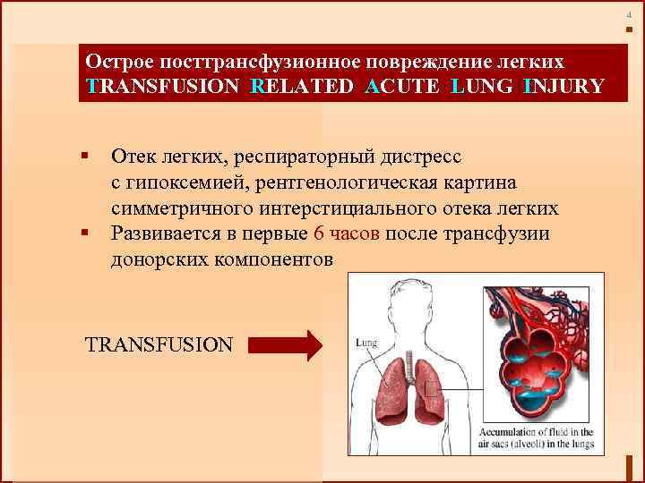 4 Острое посттрансфузионное повреждение легких TRANSFUSION RELATED ACUTE LUNG INJURY § Отек легких, респираторный