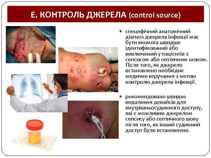 E. КОНТРОЛЬ ДЖЕРЕЛА (control source) специфічний анатомічний діагноз джерела інфекції має бути якомога швидше