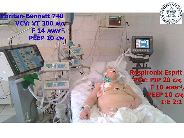 Puritan-Bennett 740 VCV: VT 300 мл, F 14 мин-1, РЕЕР 10 см Respironix Esprit