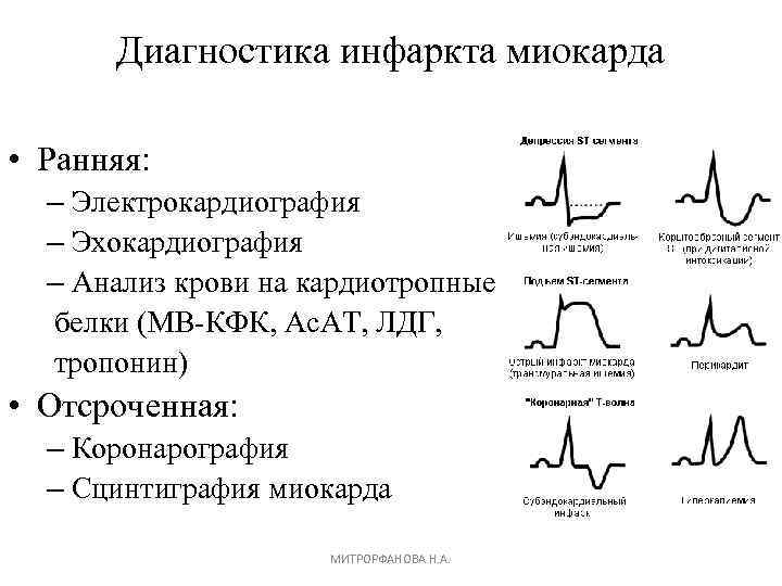 Диагноз инфаркт