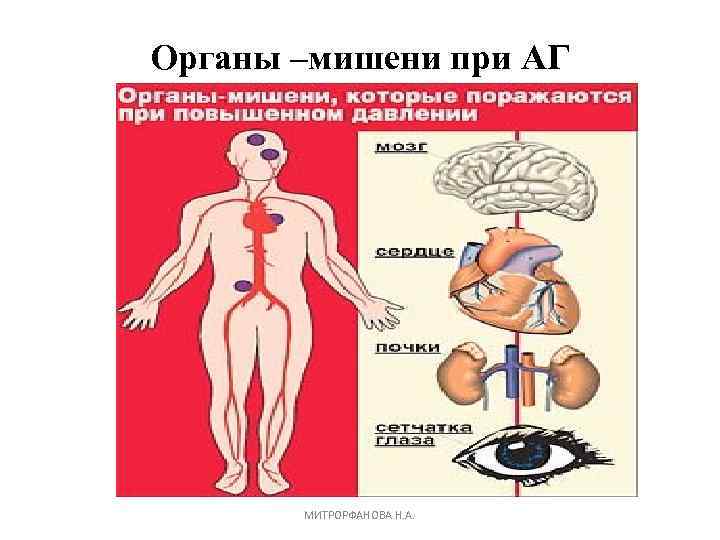 Органы мишени. Органы-мишени при гипертоническом кризе. Наружные органы мишени. Органы мишени артериальной гипертензии. Поражение органов мишеней при АГ.