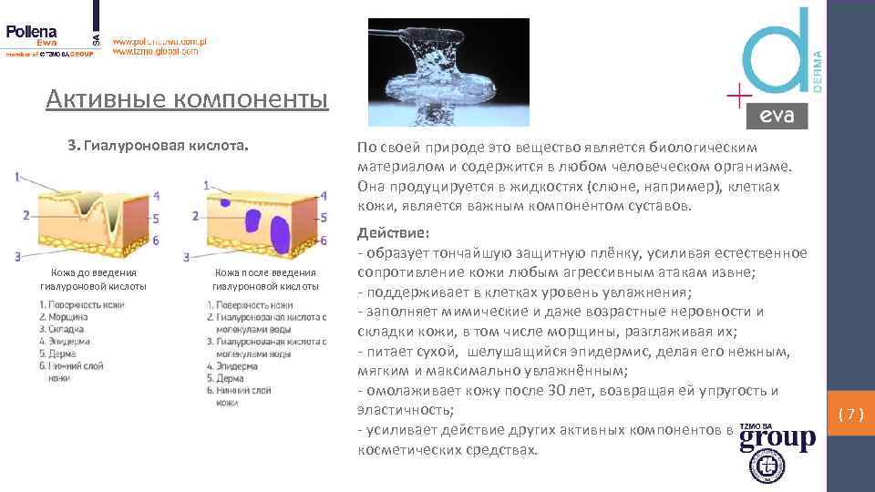 Активные компоненты 3. Гиалуроновая кислота. Кожа до введения гиалуроновой кислоты Кожа после введения гиалуроновой