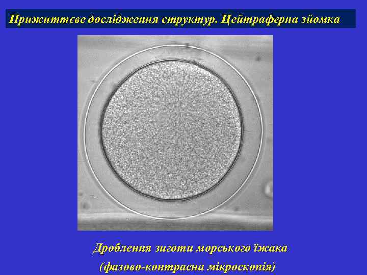 Прижиттєве дослідження структур. Цейтраферна зйомка Дроблення зиготи морського їжака (фазово-контрасна мікроскопія) 