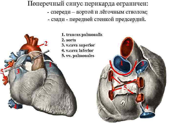 Слепой мешок в гинекологии что это