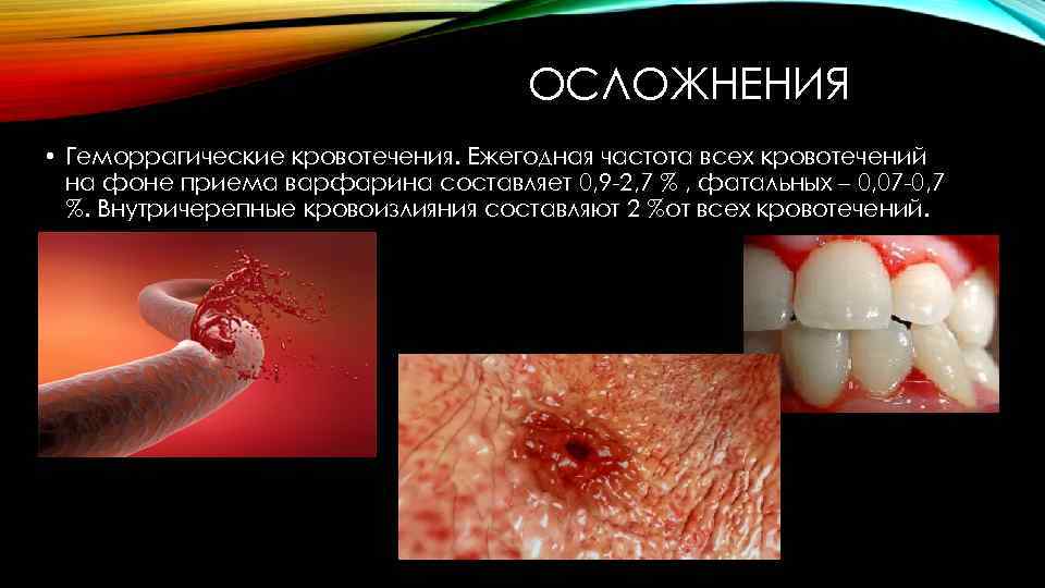 ОСЛОЖНЕНИЯ • Геморрагические кровотечения. Ежегодная частота всех кровотечений на фоне приема варфарина составляет 0,