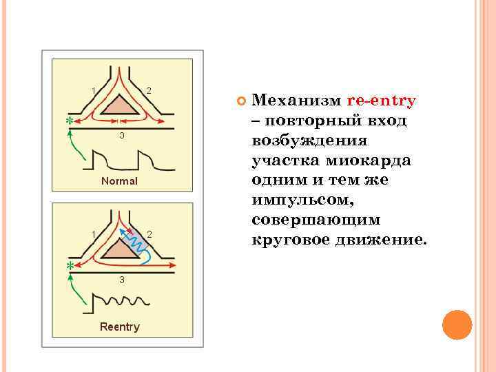  Механизм re-entry – повторный вход возбуждения участка миокарда одним и тем же импульсом,