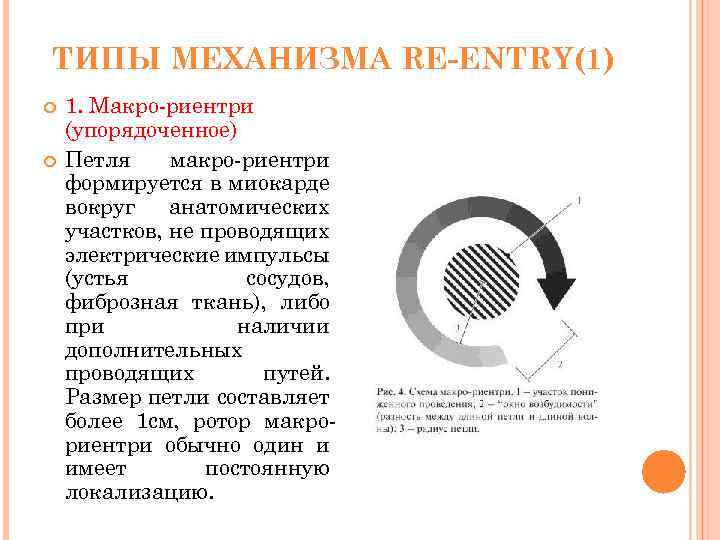 ТИПЫ МЕХАНИЗМА RE-ENTRY(1) 1. Макро-риентри (упорядоченное) Петля макро-риентри формируется в миокарде вокруг анатомических участков,
