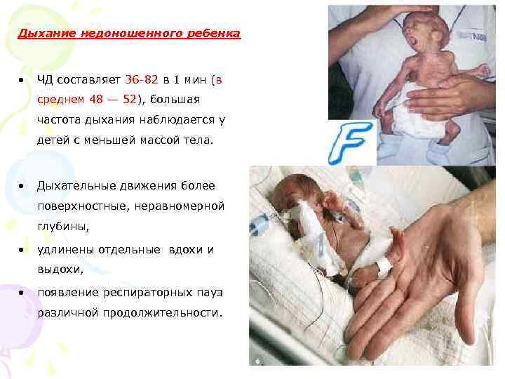 Дыхание недоношенного ребенка • ЧД составляет 36 -82 в 1 мин (в среднем 48