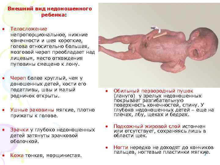 Внешний вид недоношенного ребенка: • Телосложение непропорциональное, нижние конечности и шея короткие, голова относительно