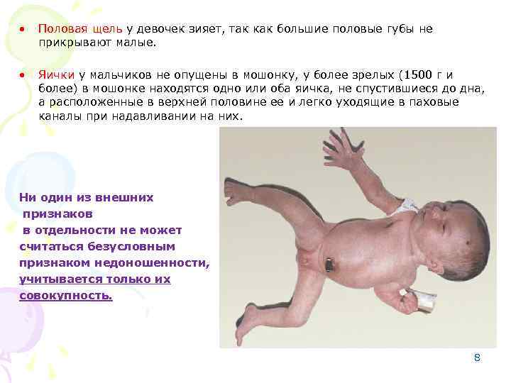  • Половая щель у девочек зияет, так как большие половые губы не прикрывают