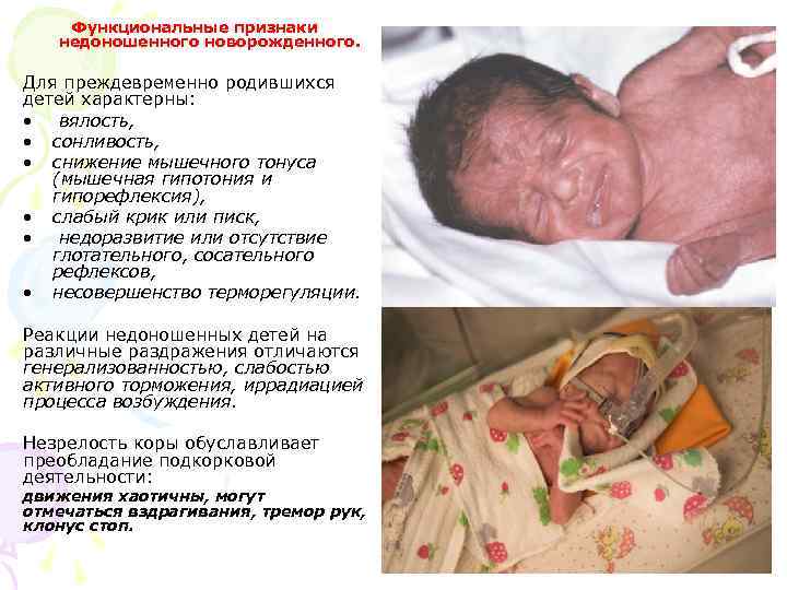 Функциональные признаки недоношенного новорожденного. Для преждевременно родившихся детей характерны: • вялость, • сонливость, •