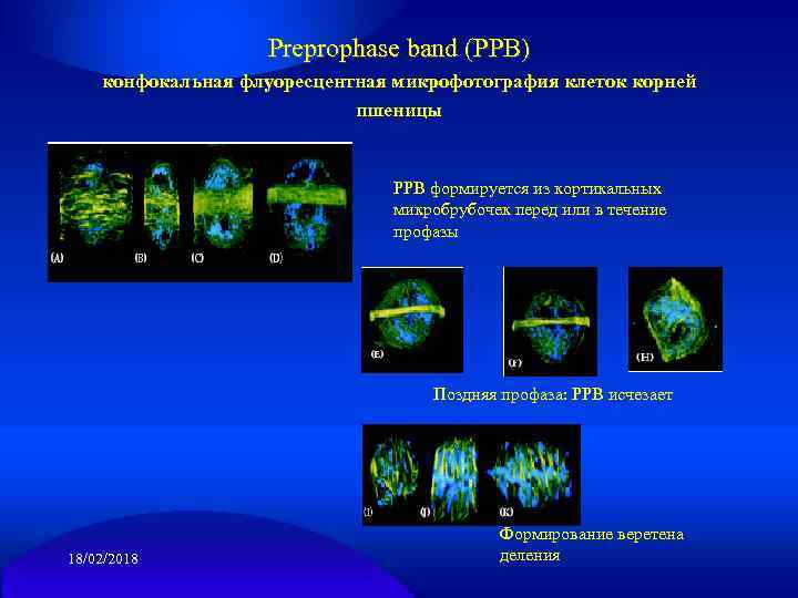 Preprophase band (PPB) конфокальная флуоресцентная микрофотография клеток корней пшеницы РРВ формируется из кортикальных микробрубочек