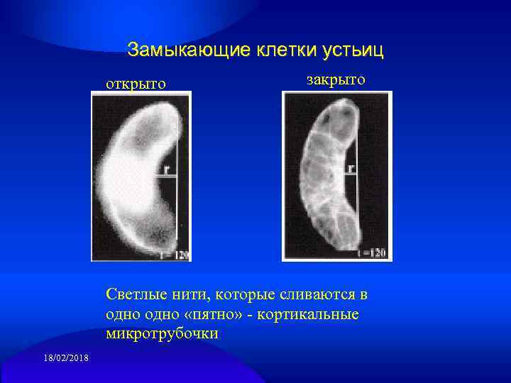 Замыкающие клетки устьиц открыто закрыто Светлые нити, которые сливаются в одно «пятно» - кортикальные