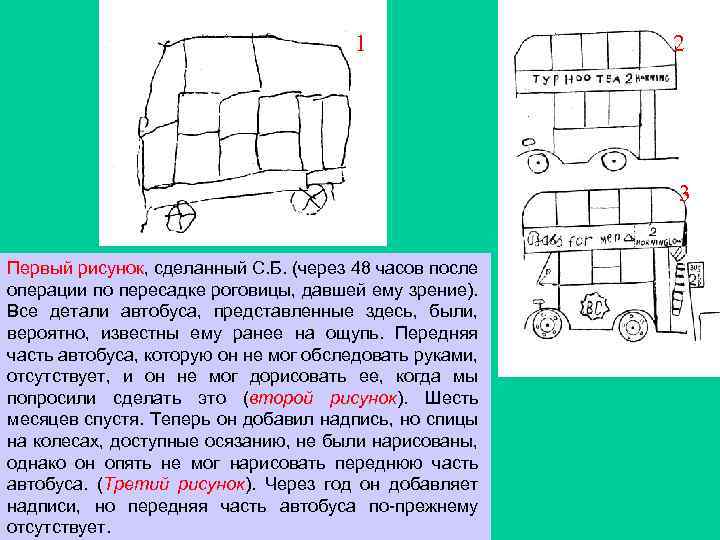 1 2 3 Первый рисунок, сделанный С. Б. (через 48 часов после операции по